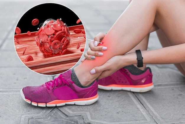 How Does Hydrochlorothiazide Help Manage Gout?