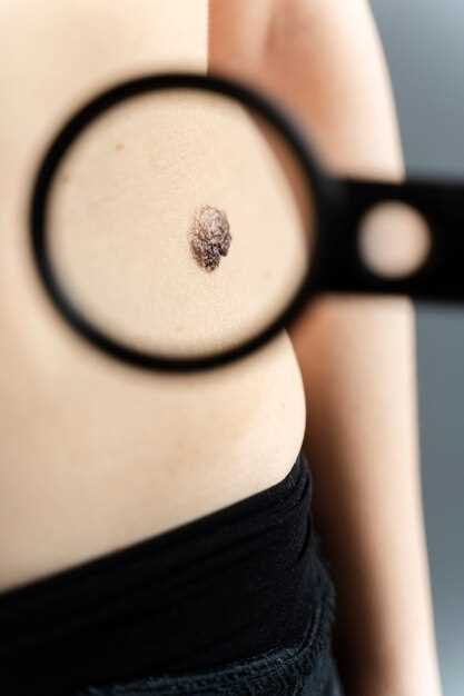 Benefits of Metformin