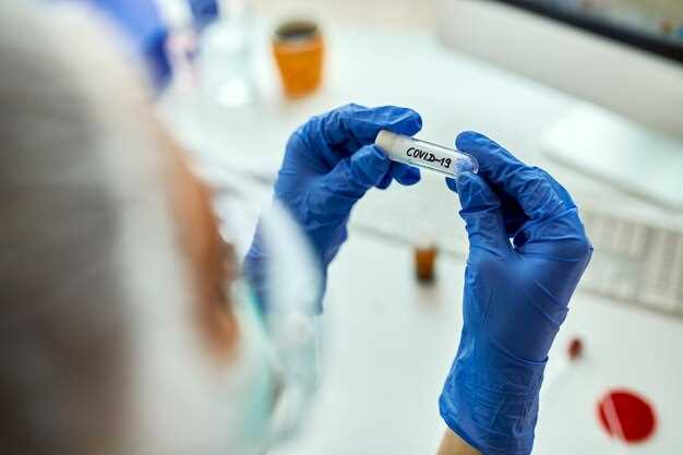 Effects of Mirtazapine and Trazodone Interaction