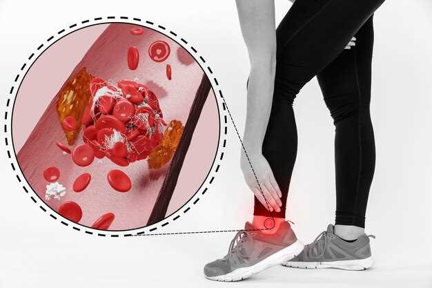 Connection Between Omeprazole and Thrombocytopenia