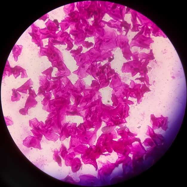 How does Planet Trial Rosuvastatin work?