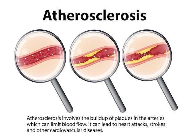 How does metformin relate to lactic acidosis?