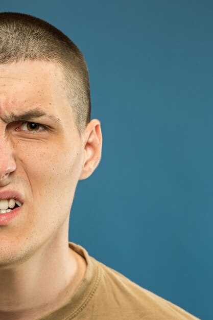 Application for Perioral Dermatitis