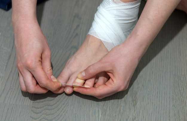 Peripheral Neuropathy